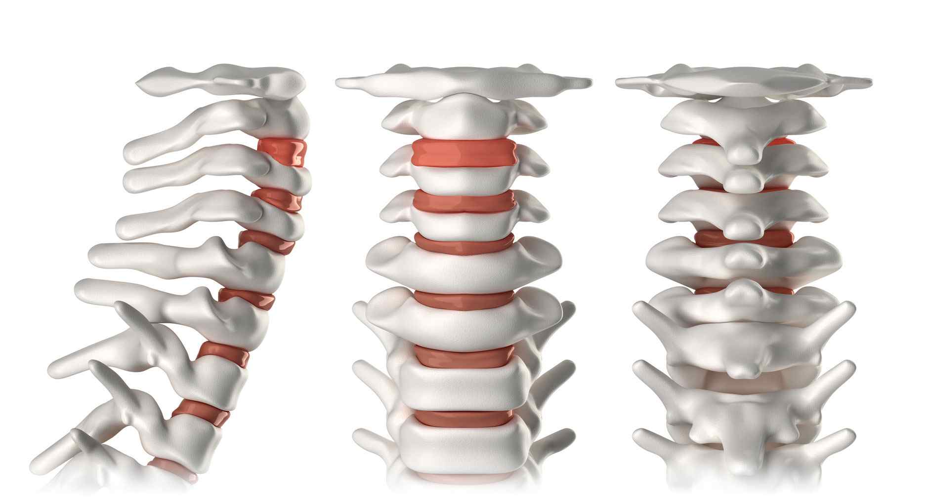 Tratamiento Integral del dolor de Columna Vertebral Cervical y Lumbar -  Clínica Alberto Albert